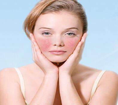 臉部過敏怎么辦