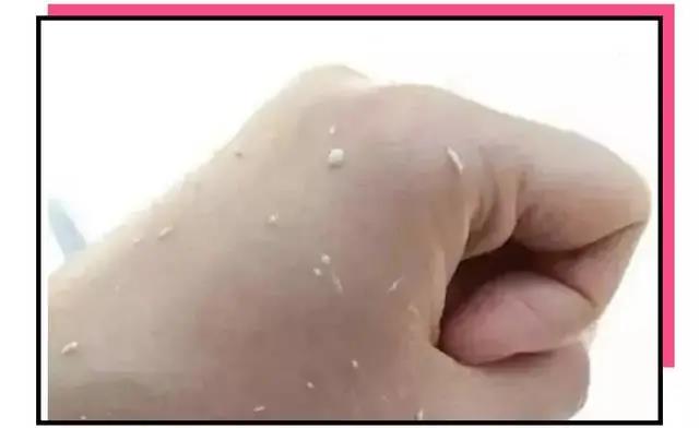 使用護膚品搓泥的原因有哪些？護膚品搓泥怎么辦？