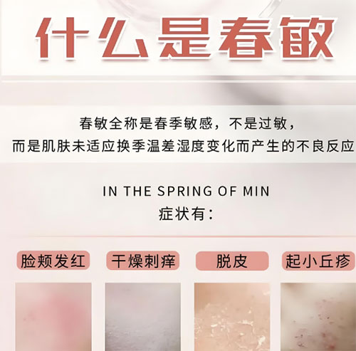 春敏是什么？如何有效預(yù)防春敏？
